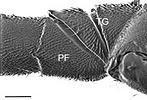 Gasteruption sp. hind trochanter (leg)