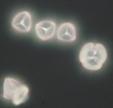 Lycopodium spores. Tetrad (right) and single spores showing trilete marks.